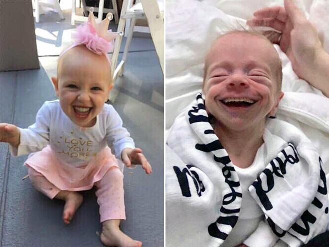 Babies with adult teeth look terrifying.